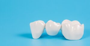 how to care for your dental bridge